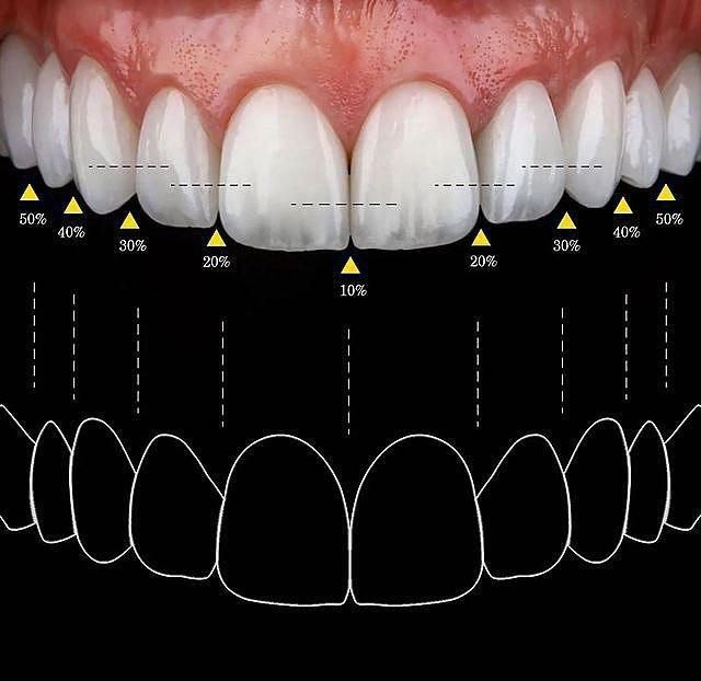 اصول طراحی لبخند