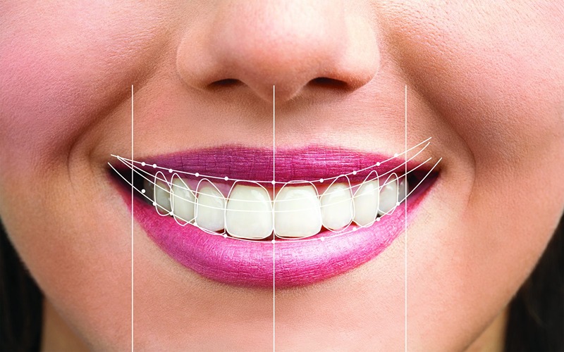 طراحی لبخند در مشهد