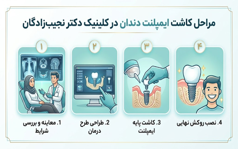 ایمپلنت دندان نزدیک بلوار فکوری مشهد