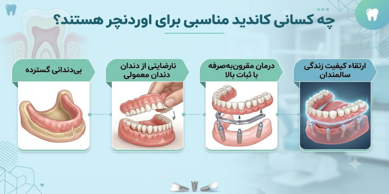 اوردنچر متکی بر ایمپلنت چیست