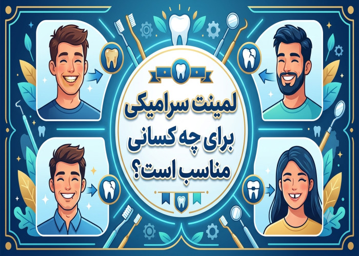 لمینت سرامیکی برای چه کسانی مناسب است