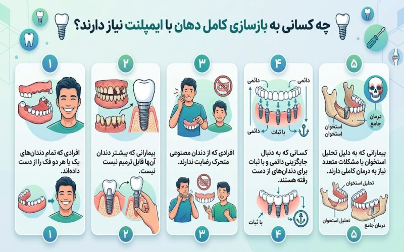 بازسازی کامل دهان با ایمپلنت