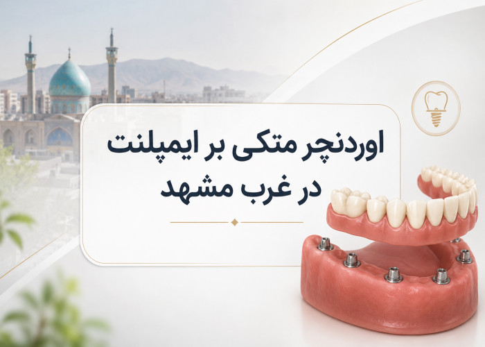 اوردنچر متکی بر ایمپلنت در غرب مشهد