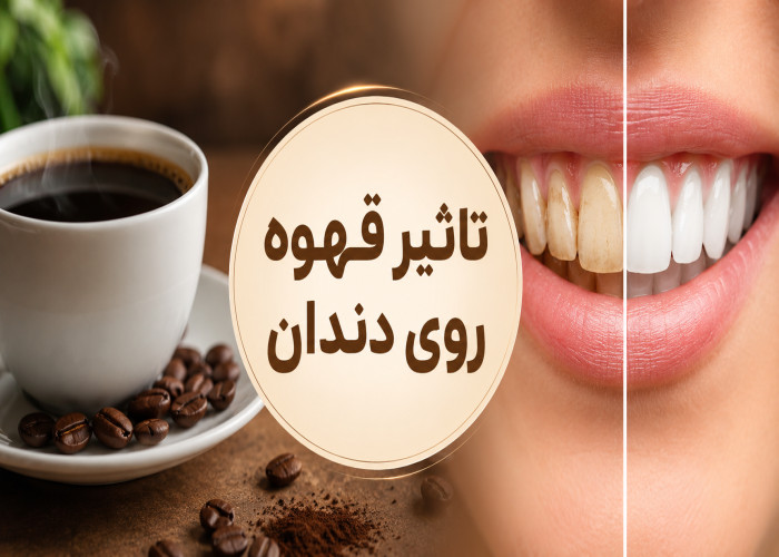 تأثیر قهوه روی دندان