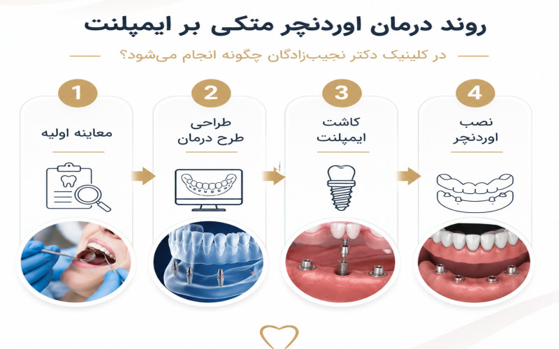 اوردنچر متکی بر ایمپلنت در غرب مشهد