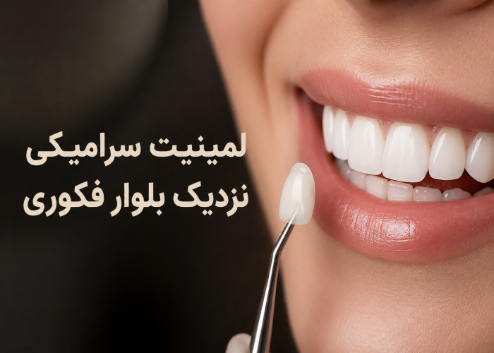 لمینیت سرامیکی نزدیک بلوار فکوری