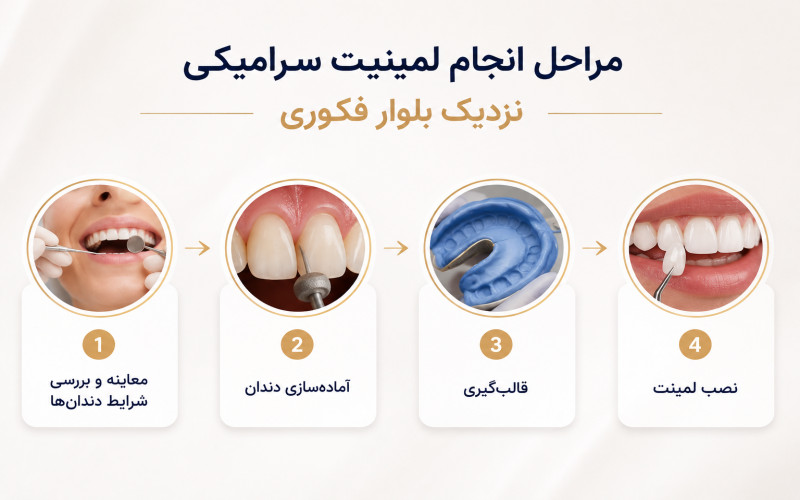 لمینیت سرامیکی نزدیک بلوار فکوری