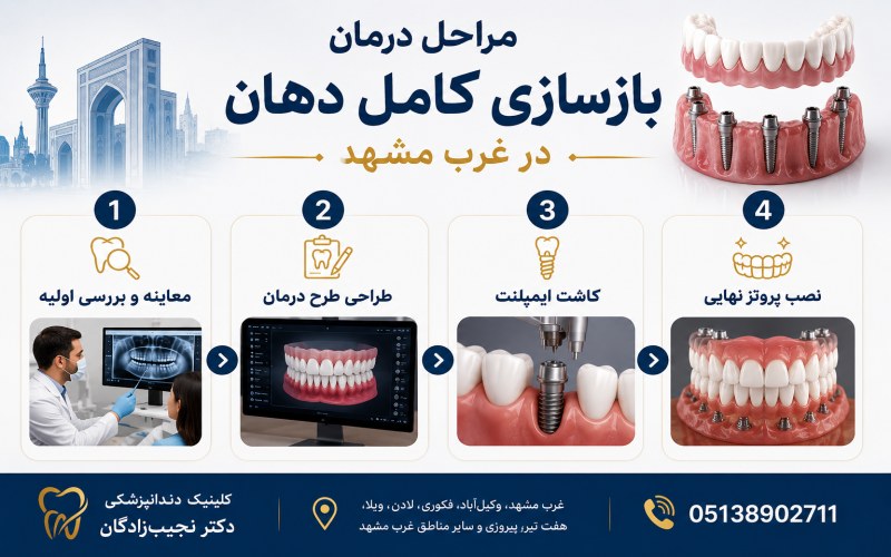 مراحل درمان بازسازی کامل دهان در غرب مشهد