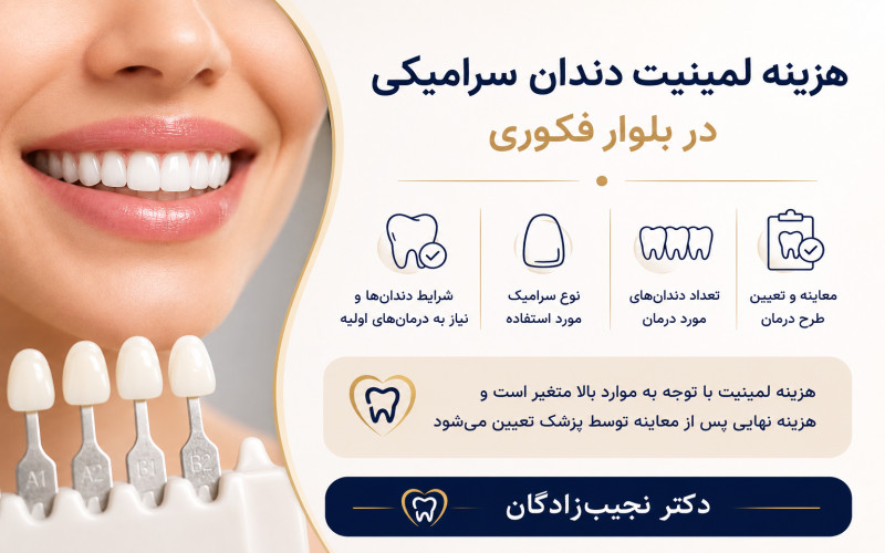 هزینه لمینیت سرامیکی در بلوار فکوری