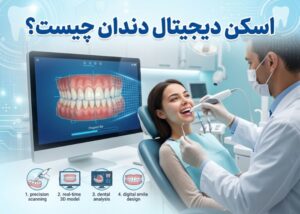 اسکن دیجیتال دندان