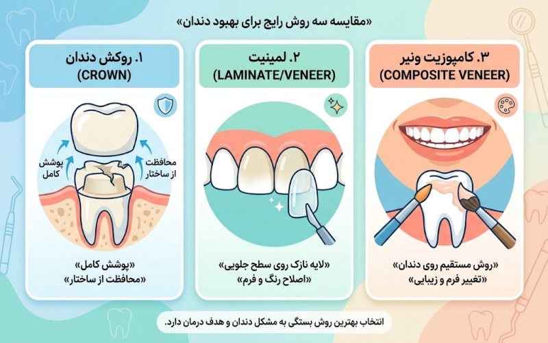 روکش دندان