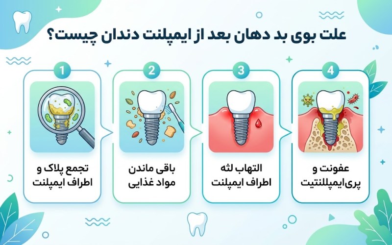 علت بوی بد دهان بعد از ایمپلنت دندان چیست