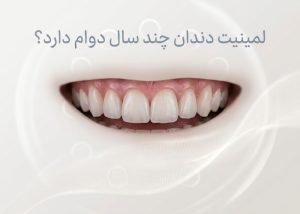 لمینیت دندان چند سال دوام دارد